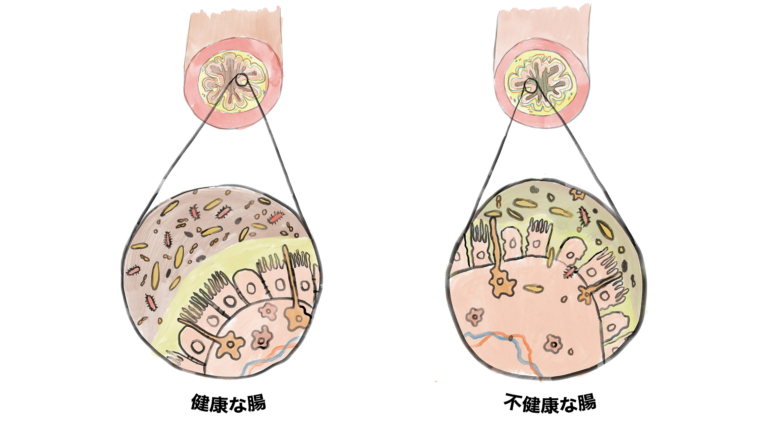 腸内微生物を育てる